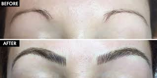 image-641834-microblading-2.png